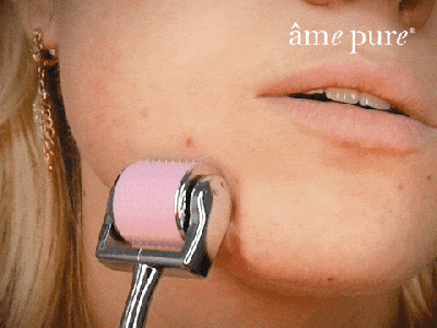 My 4-week Experience with Dermaroller&nbsp;Philippines